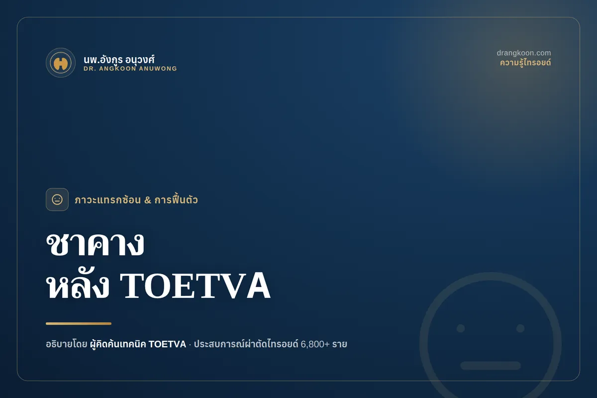 ชาคางหลังผ่าตัดไทรอยด์ส่องกล้องทางช่องปาก (TOETVA) จะหายไหม?
