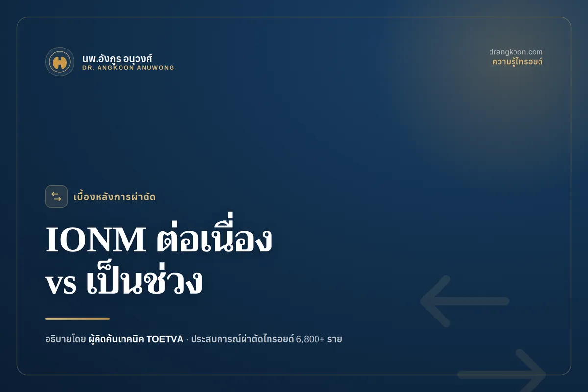 C-IONM กับ I-IONM ต่างกันอย่างไร? เทคโนโลยีติดตามเส้นประสาทในการผ่าตัดไทรอยด์