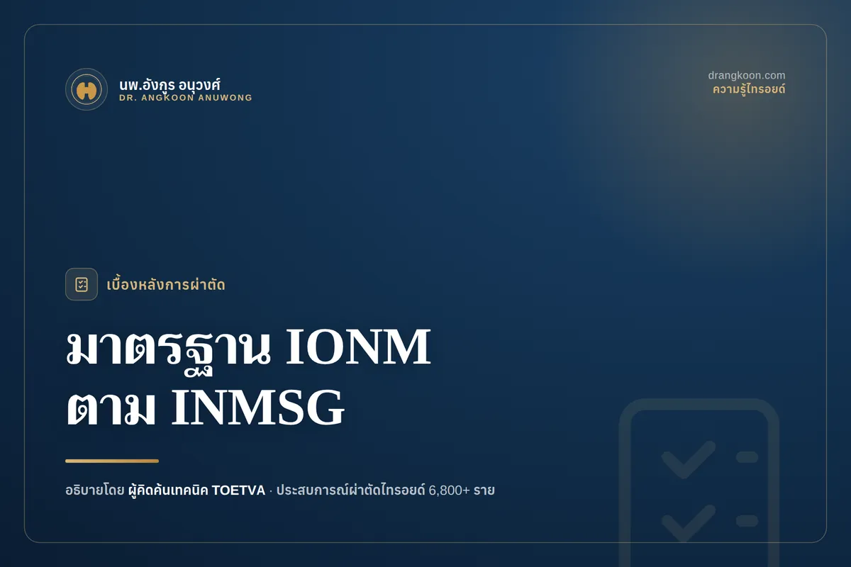 มาตรฐาน IONM ตาม INMSG: V1–R1–R2–V2 คืออะไร?