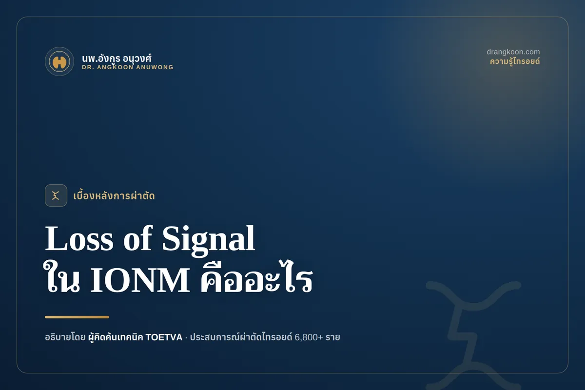 Loss of Signal (LOS) ใน IONM คืออะไร? ทำไมสัญญาณหายไม่ได้แปลว่าเส้นประสาทถูกตัด