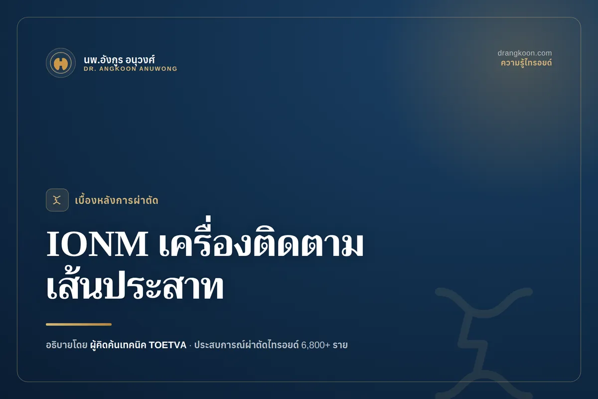 IONM เครื่องติดตามเส้นประสาทขณะผ่าตัด ช่วยลดความเสี่ยงได้อย่างไร?
