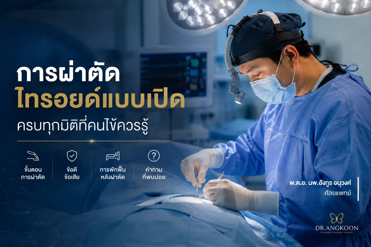 ผ่าตัดไทรอยด์แบบเปิด ครบทุกมิติที่คนไข้ควรรู้