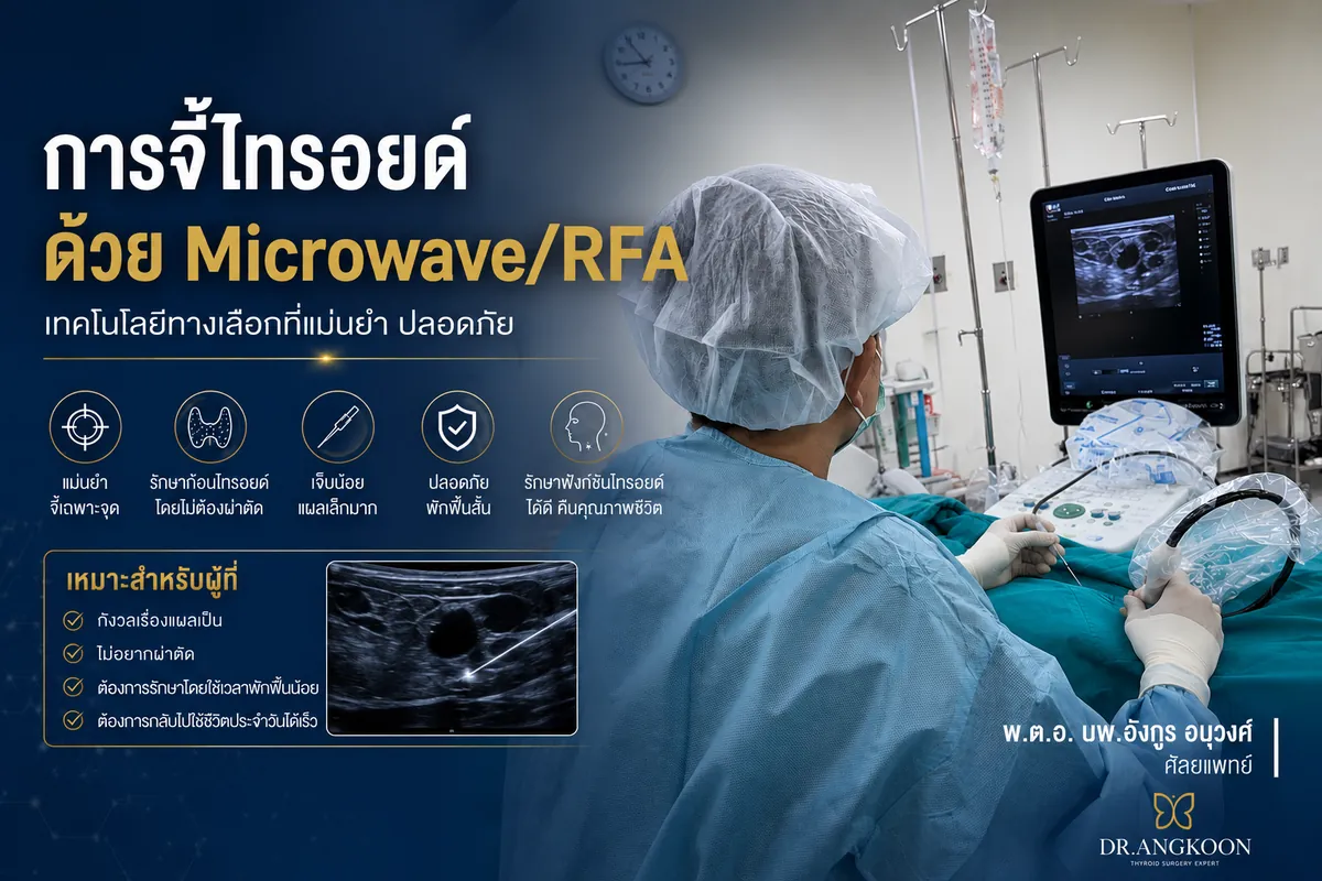 จี้ไทรอยด์ RFA Microwave รักษาก้อนไทรอยด์โดยไม่ต้องผ่าตัด
