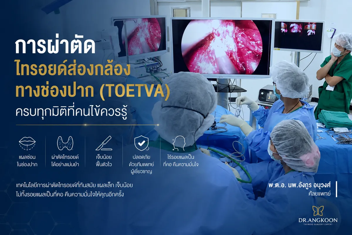 ผ่าตัดไทรอยด์ส่องกล้องทางช่องปาก TOETVA ไร้แผลที่คอ