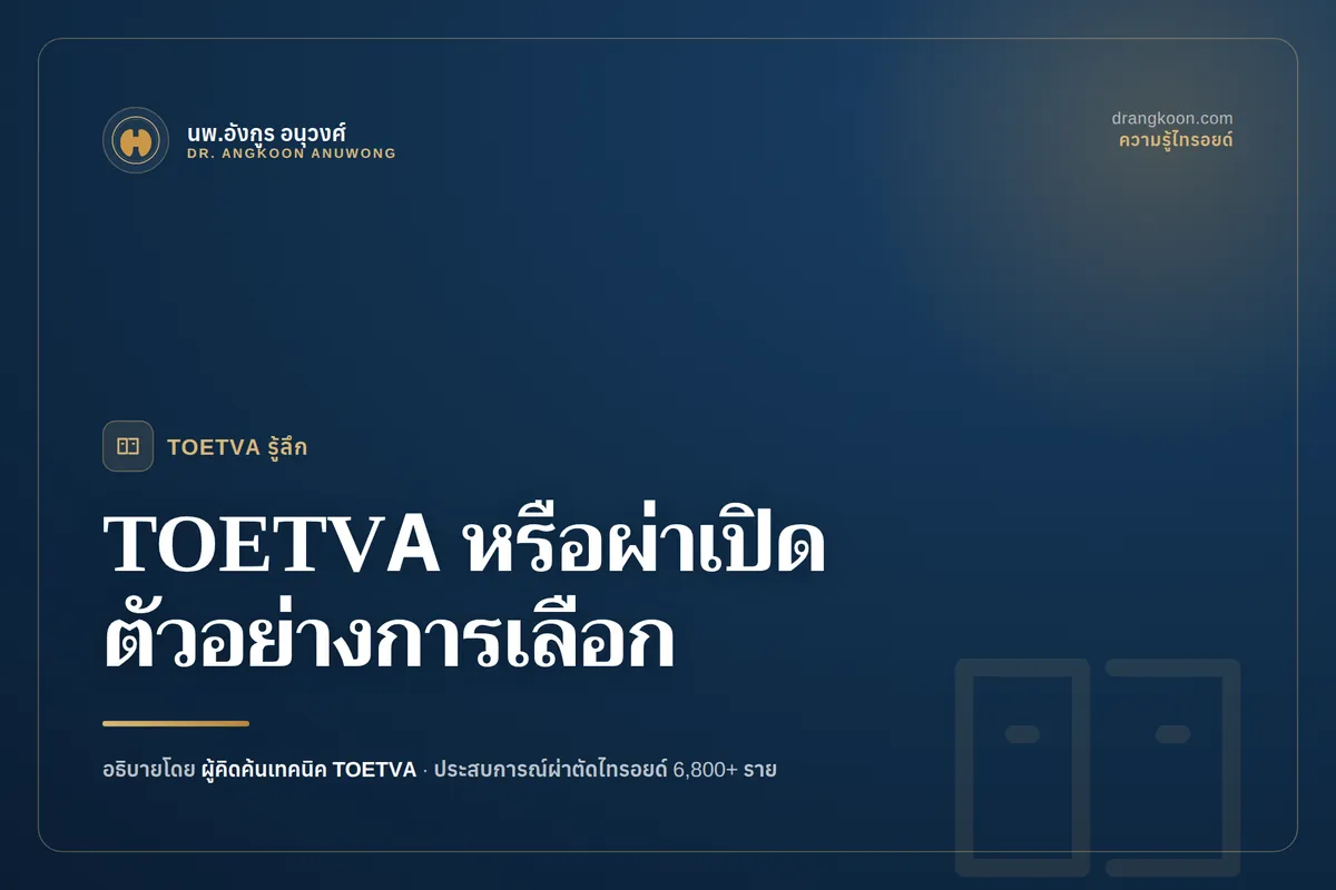 TOETVA หรือผ่าตัดไทรอยด์แบบเปิด? ตัวอย่างสถานการณ์ที่เหมาะกับแต่ละวิธี