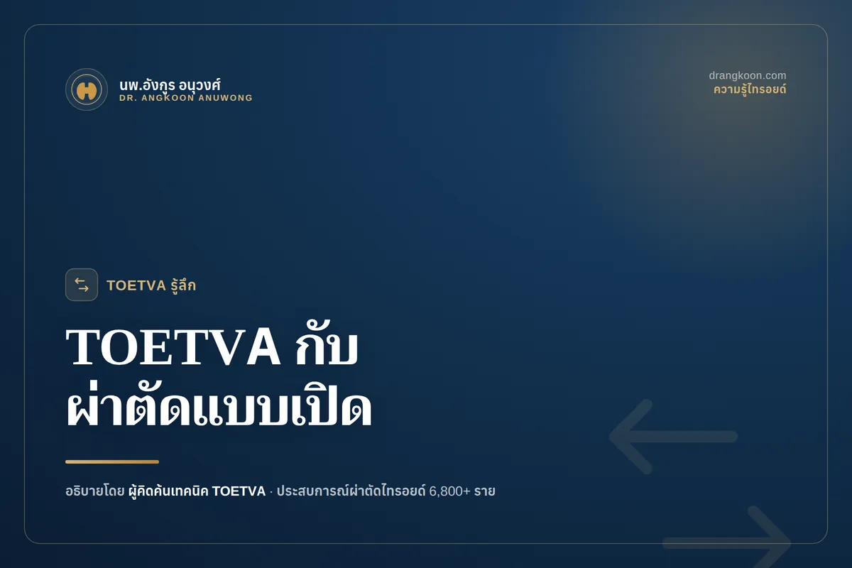 TOETVA กับผ่าตัดไทรอยด์แบบเปิด ต่างกันอย่างไร? วิธีไหนเหมาะกับคุณ